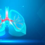 What Are The Common Lung Cancer Screening Tests?